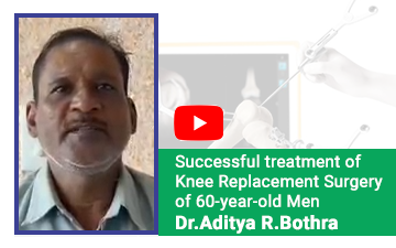 Successful treatment of Knee Replacement Surgery of 60-year-old Men by Dr.Aditya R.Bothra.